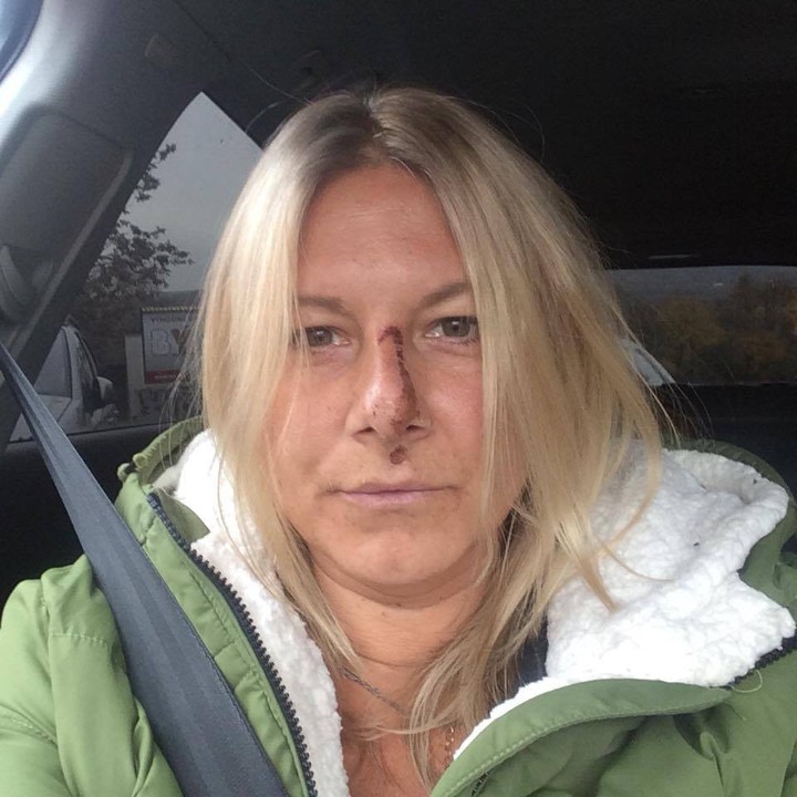 Moja mama - Zuzka Sabolova - zranenie